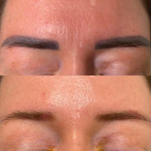 detatouage-sourcils-2-elle-et-belle