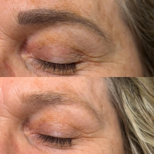 detatouage-sourcils-elle-et-belle